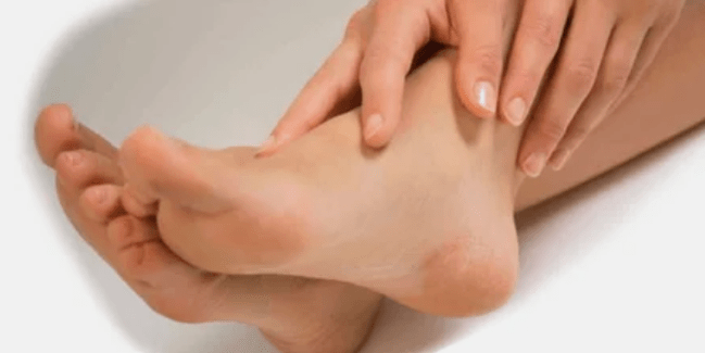 Traitement du champignon des ongles